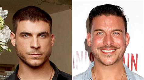 how old is jax taylor|jax before and after.